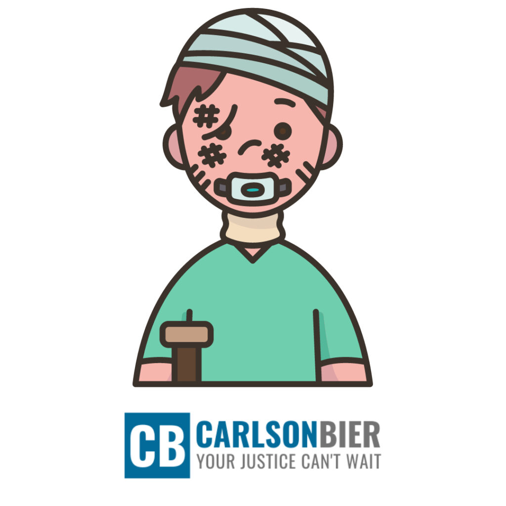 Personal Injury Lawyer Bartlett Il | Carlson Bier | Personal Injury Lawyer Near Me | Best Personal Injury Lawyer Bartlett Il