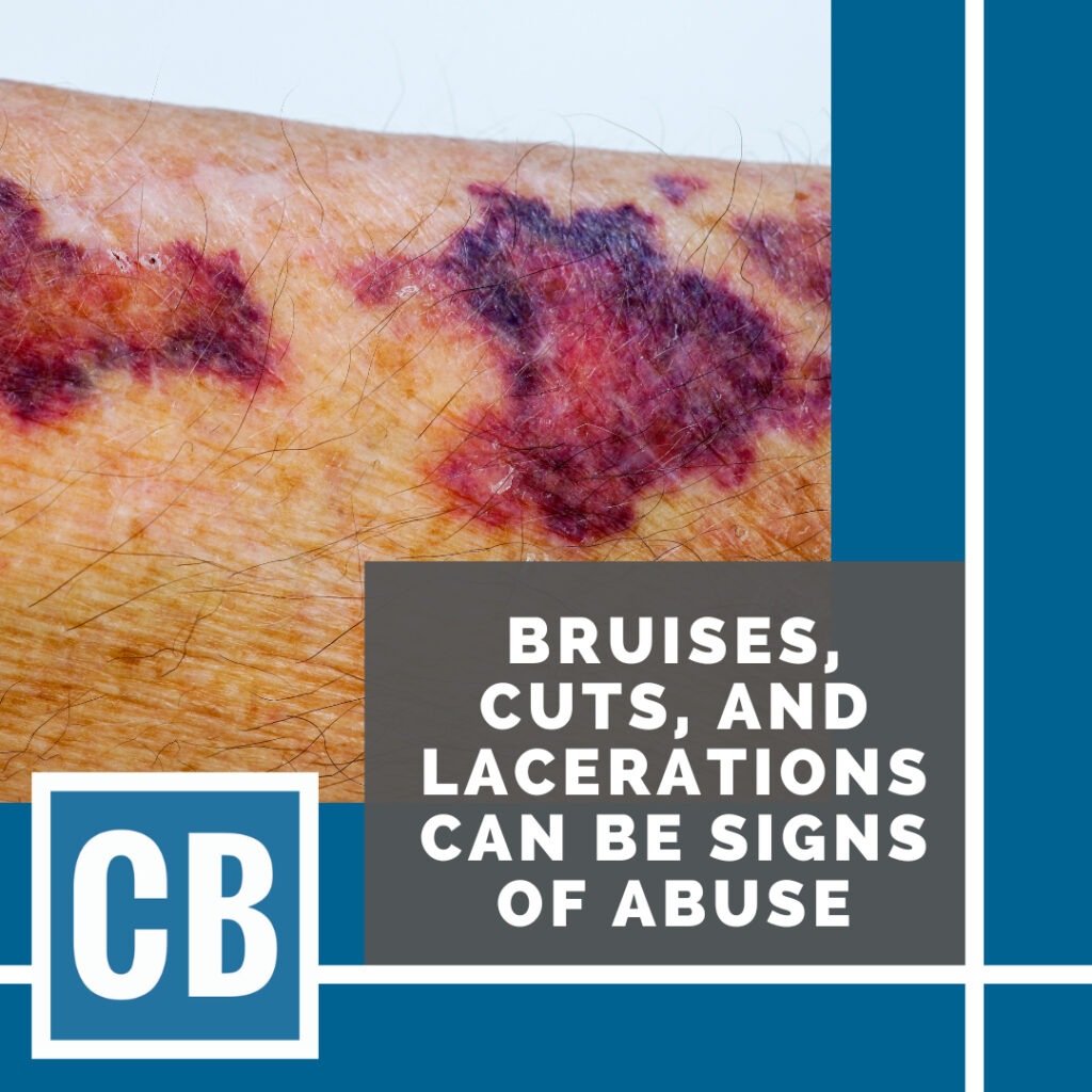 Nursing Home Abuse Lawyer In Bartlett Illinois | Carlson Bier Associates