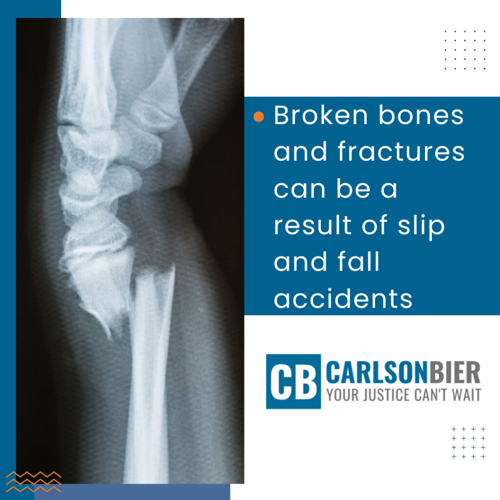 Personal Injury Lawyer Orland Park Illinois | Carlson Bier Associates